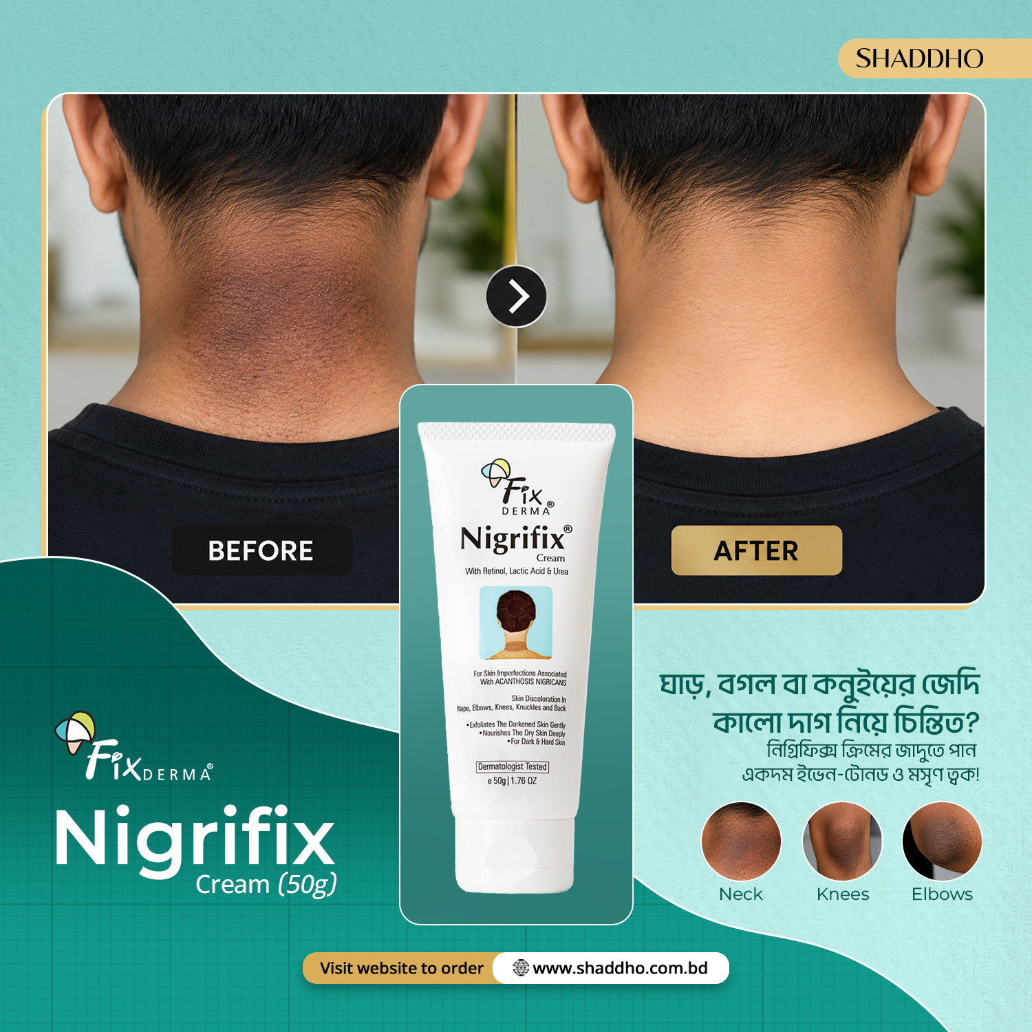 Fixderma Nigrifix Cream (50g)
