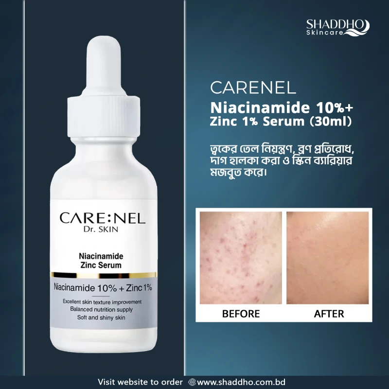 CareNel Niacinamide 10% Zinc 1% Serum (30ml)