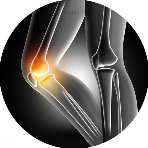 Bone & Joint Health