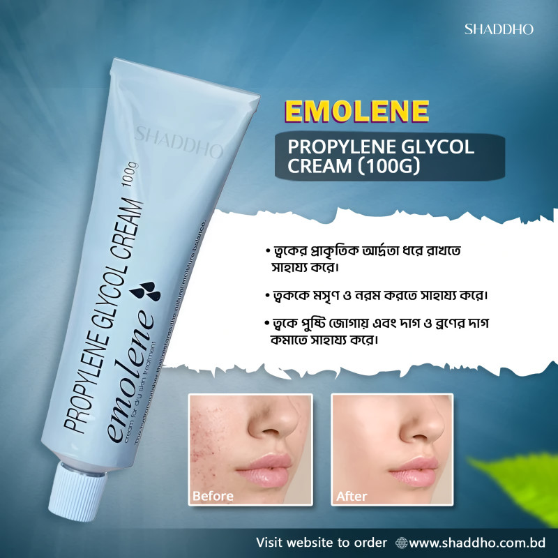 Emolene Propylene Glycol Cream (100g)